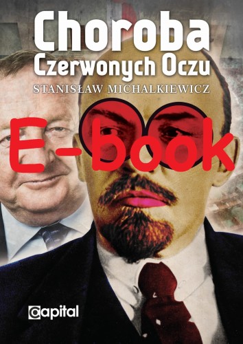 (E-book) Stanisław Michalkiewicz - Choroba czerwonych oczu.jpg